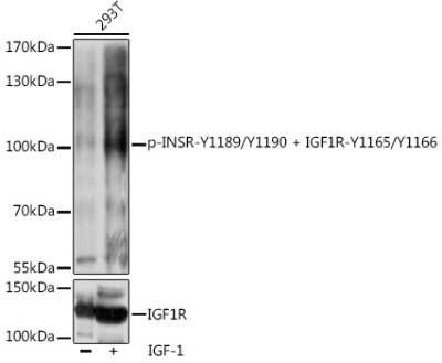 Western Blot: IGF1R/Insulin R [p Tyr1190, p Tyr1189, p Tyr1166, p Tyr1165] AntibodyAzide and BSA Free [NBP3-16685]